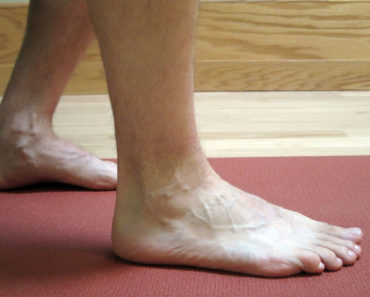 Ankle sprain physiotherapy-the most painful injury